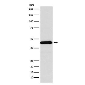 SSTR5 (13S14)兔单抗,SSTR5 (13S14) Rabbit Monoclonal Antibody