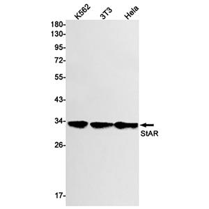 StAR (13D4)兔单抗,StAR (13D4) Rabbit Monoclonal Antibody