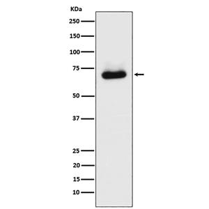 STK39 (18P19)兔单抗,STK39 (18P19) Rabbit Monoclonal Antibody