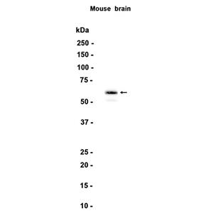 STXBP1 (6W16)兔单抗,STXBP1 (6W16) Rabbit Monoclonal Antibody