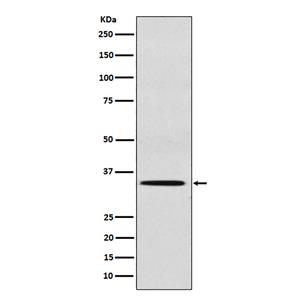 SULT2A1 (5Q7)兔单抗,SULT2A1 (5Q7) Rabbit Monoclonal Antibody