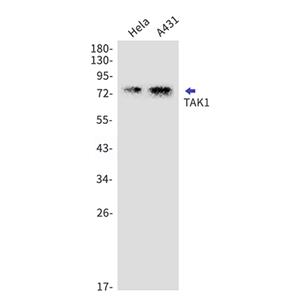 TAK1 (13O7)兔单抗,TAK1 (13O7) Rabbit Monoclonal Antibody