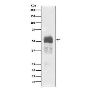 Tau (5W5)兔单抗,Tau (5W5) Rabbit Monoclonal Antibody