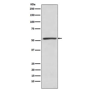 TBLR1 (6N18)兔单抗,TBLR1 (6N18) Rabbit Monoclonal Antibody
