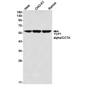 TCP1 alpha (7M19)兔单抗,TCP1 alpha (7M19) Rabbit Monoclonal Antibody