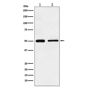 TIM1 (19P10)兔单抗,TIM1 (19P10) Rabbit Monoclonal Antibody