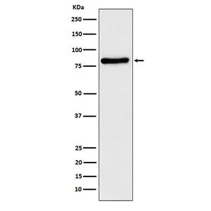 TLE1 (19X14)兔单抗,TLE1 (19X14) Rabbit Monoclonal Antibody