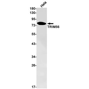 TRIM56 (5Y14)兔单抗,TRIM56 (5Y14) Rabbit Monoclonal Antibody