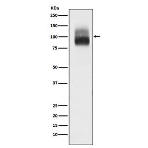 TrkB (3K17)兔单抗,TrkB (3K17) Rabbit Monoclonal Antibody