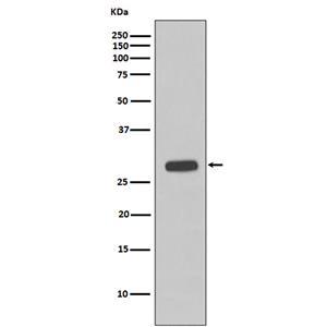 Troponin I (14Z15)兔单抗,Troponin I (14Z15) Rabbit Monoclonal Antibody