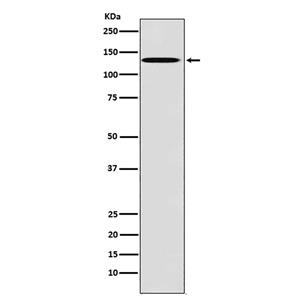 TYRO3 (5G16)兔单抗,TYRO3 (5G16) Rabbit Monoclonal Antibody