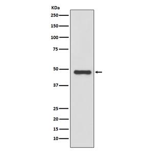 Urokinase (4A13)兔单抗,Urokinase (4A13) Rabbit Monoclonal Antibody
