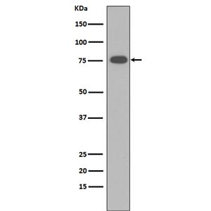 Vitronectin  (1N16)兔单抗,Vitronectin  (1N16) Rabbit Monoclonal Antibody