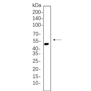 Cytokeratin 20兔单抗,Cytokeratin 20 Rabbit Monoclonal antibody