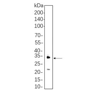 IL-1 β兔单抗,IL-1 β Rabbit Monoclonal antibody