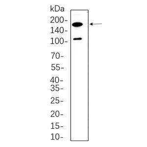 Rictor兔单抗,Rictor Rabbit Monoclonal antibody