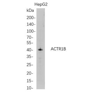 ACTR1B兔单抗,ACTR1B Rabbit Monoclonal antibody