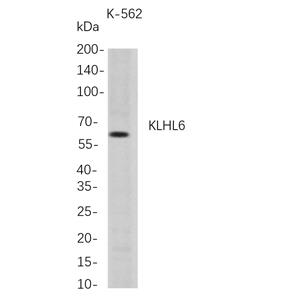 KLHL6兔单抗,KLHL6 Rabbit Monoclonal antibody