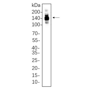 HDAC4兔单抗,HDAC4 Rabbit Monoclonal antibody