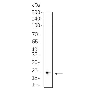4E-BP1兔单抗,4E-BP1 Rabbit Monoclonal antibody