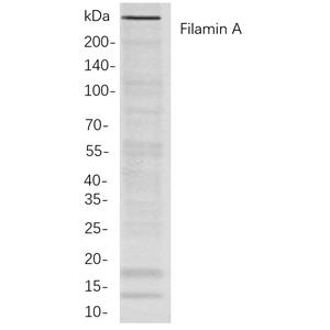 Filamin A兔单抗,Filamin A Rabbit Monoclonal antibody