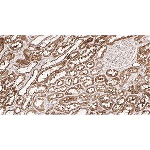 Pyruvate Dehydrogenase E1 α兔单抗,Pyruvate Dehydrogenase E1 α Rabbit Monoclonal antibody