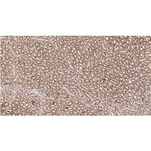 Pyruvate Dehydrogenase E1 α兔单抗,Pyruvate Dehydrogenase E1 α Rabbit Monoclonal antibody