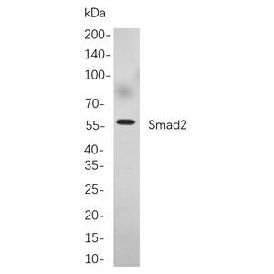 Smad2兔单抗,Smad2 Rabbit Monoclonal antibody