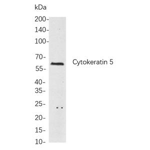 Cytokeratin 5兔单抗,Cytokeratin 5 Rabbit Monoclonal antibody