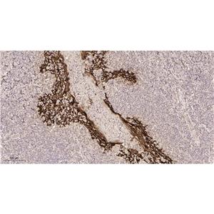 Cytokeratin 5兔单抗,Cytokeratin 5 Rabbit Monoclonal antibody