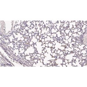 Cytokeratin 5兔单抗,Cytokeratin 5 Rabbit Monoclonal antibody
