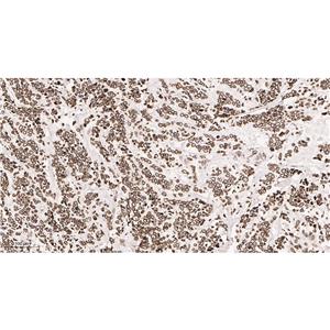 Lamin B1兔单抗,Lamin B1 Rabbit Monoclonal antibody
