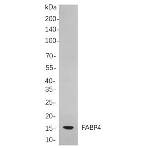 FABP4兔单抗,FABP4 Rabbit Monoclonal antibody