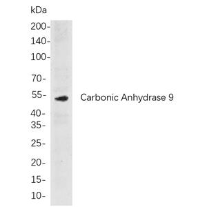 Carbonic Anhydrase 9兔单抗,Carbonic Anhydrase 9 Rabbit Monoclonal antibody
