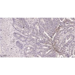 Carbonic Anhydrase 9兔单抗,Carbonic Anhydrase 9 Rabbit Monoclonal antibody