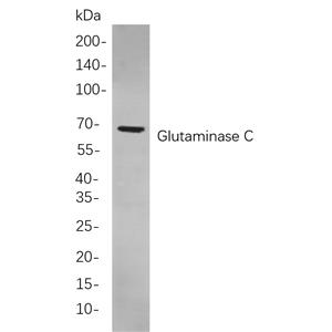 Glutaminase C兔单抗,Glutaminase C Rabbit Monoclonal antibody