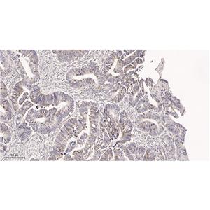 Glutaminase C兔单抗,Glutaminase C Rabbit Monoclonal antibody