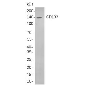 CD133兔单抗,CD133 Rabbit Monoclonal antibody