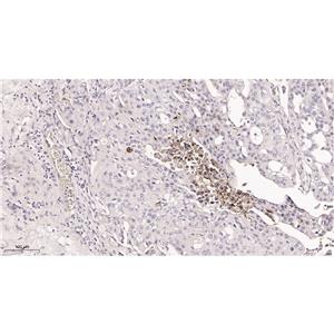 CD133兔单抗,CD133 Rabbit Monoclonal antibody