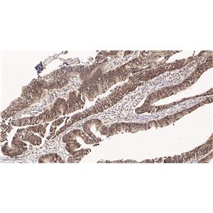 Cyclin E1兔单抗,Cyclin E1 Rabbit Monoclonal antibody