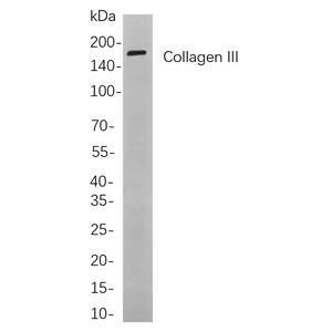 Collagen III兔单抗,Collagen III Rabbit Monoclonal antibody