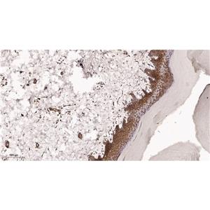 Collagen III兔单抗,Collagen III Rabbit Monoclonal antibody