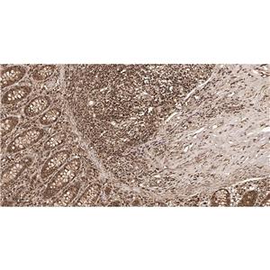 Lactate Dehydrogenase Isoenzyme V兔单抗,Lactate Dehydrogenase Isoenzyme V Rabbit Monoclonal antibody