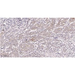 AMPK α1兔单抗,AMPK α1 Rabbit Monoclonal antibody