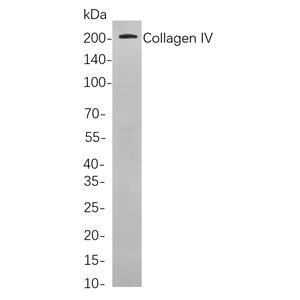 Collagen IV兔单抗,Collagen IV Rabbit Monoclonal antibody