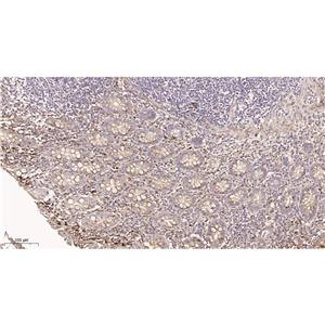 Collagen IV兔单抗,Collagen IV Rabbit Monoclonal antibody