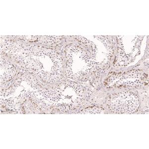 Hsp90兔单抗,Hsp90 Rabbit Monoclonal antibody