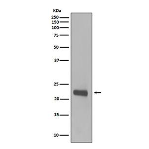 Caveolin 1兔多抗,Caveolin 1 Rabbit Polyclonal Antibody