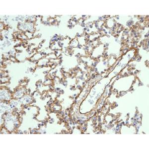 Caveolin 1兔多抗,Caveolin 1 Rabbit Polyclonal Antibody