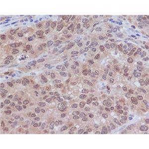 ERK2兔多抗,ERK2 Rabbit Polyclonal Antibody